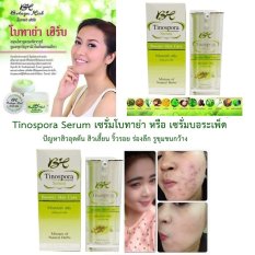 Botaya Tinospora Serum เซรั่มโบทาย่า หรือ เซรั่มบอระเพ็ด สมุนไพรสูตรมหัศจรรย์ ช่วยลด ปัญหาสิวอุดตัน สิวเสี้ยน ริ้วรอย ร่องลึก รูขุมขนกว้าง ผิวไม่กระชับ 15ml. 5 ชิ้น Botaya Tinospora Serum เซรั่มโบทาย่า หรือ เซรั่มบอระเพ็ด สมุนไพรสูตรมหัศจรรย์ ช่วยลด ปัญหาสิวอุดตัน สิวเสี้ยน ริ้วรอย ร่องลึก รูขุมขนกว้าง ผิวไม่กระชับ 15ml. 5 ชิ้น