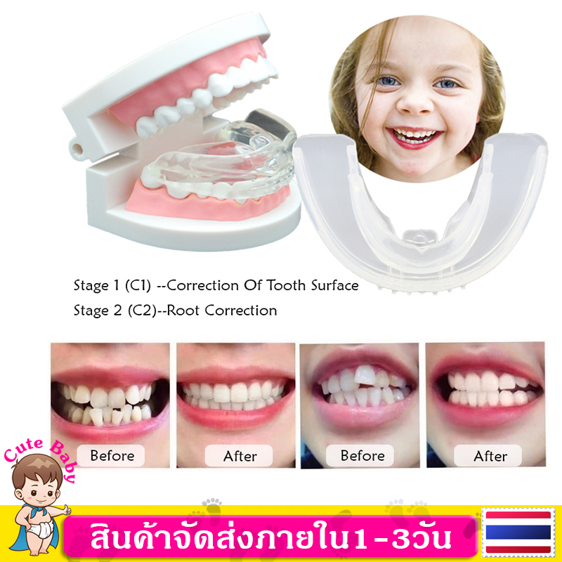 ยางกันฟัน ยางครอบฟันเด็ก ฟันยาง แก้นอนกัดฟัน Invisible Tooth Orthodontic Phase 1-2 Appliance Alignment Transparent Invisible Braces Anti-wear Tooth Guard Free Portable Box MY159