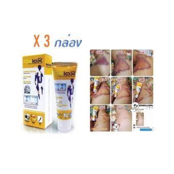 ราคา Relax Cream รีแลกซ์ ครีม บรรเทาอาการเจ็บปวด ลดอาการอักเสบ ของข้อต่อและเอ็น ต่อต้านอนุมูลอิสละ ยังยั้งการสร้าง และต้านการออกฤทธิ์ ของการก่อการอักเสบ บรรจุ 3 กล่อง